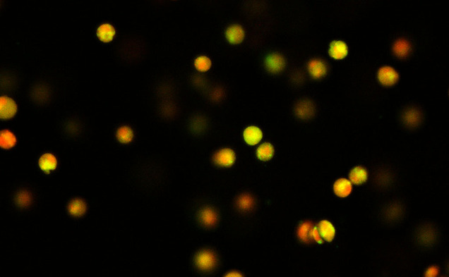 Researchers at Duke University have identified a protein crucial in the process of sensing and converting physical strain into cell growth in cartilage tissues.